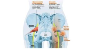 Muscolo piriforme